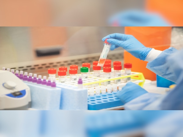 ମହାରାଷ୍ଟ୍ରରେ ଗୋଟିଏ ଦିନରେ ରେକର୍ଡ ସଂଖ୍ୟକ କୋରୋନା ସଂକ୍ରମିତ ଚିହ୍ନଟ, ୨ ଲକ୍ଷ ଟପିଲା ପଜିଟିଭ ମାମଲା