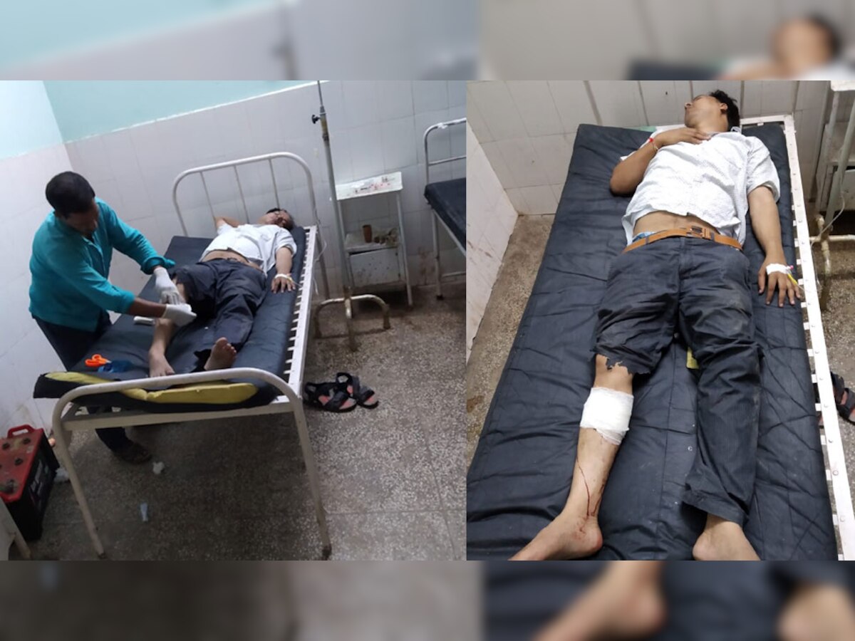 आगरा बस हाईजैक: मास्टरमाइंड प्रदीप गुप्ता की पुलिस से मुठभेड़, पैर में गोली लगी