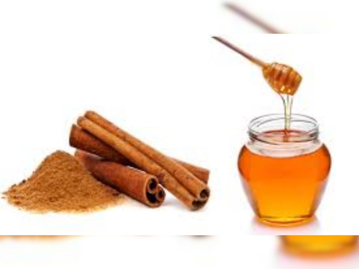 Home Remedies to cure PCOD | Home Remedies For PCOD: PCOD से बचने के ...