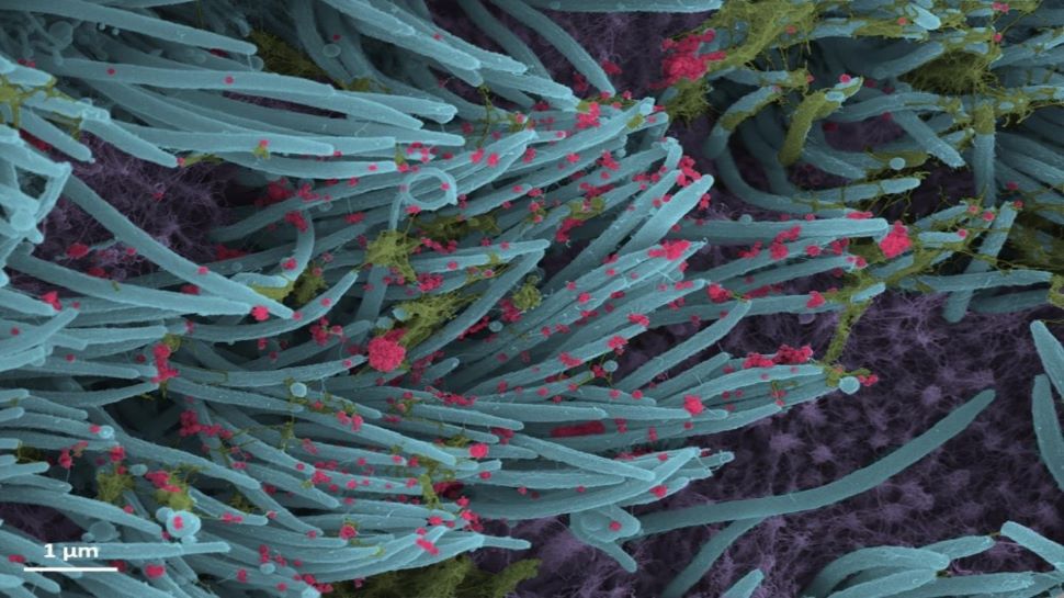 ग्राफिक डिटेल्स में सामने आई तस्वीर, करीब से कुछ ऐसा दिखता है नया Coronavirus ग्राफिक डिटेल्स में सामने आई तस्वीर, करीब से कुछ ऐसा दिखता है नया Coronavirus