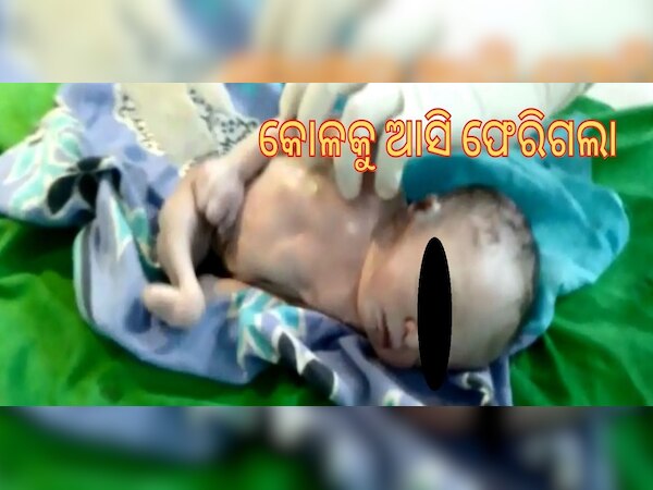 ଏକଗୋଡିଆ ଶିଶୁ