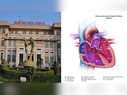 SMS हॉस्पिटल के डॉक्टर्स ने एक युवती को ऐसे दी नई ज़िंदगी, बन गई विश्वस्तरीय उपलब्धि