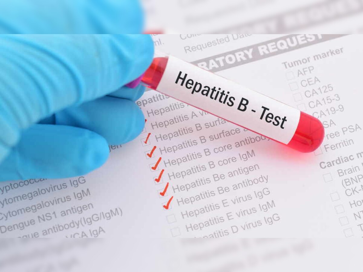 बेहद खतरनाक है Hepatitis B, जानें लक्षण, बचाव और कैसे फैलता है रोग