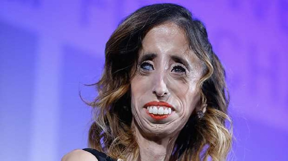 top most ugliest people in the world Ugliest People: à¤¯à¥‡.