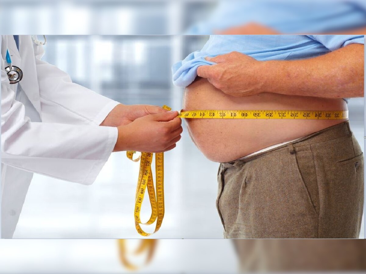 मोटापे से परेशान लोगों के लिए खुशखबरी, पटना IGIMS में करा सकते हैं इसकी सर्जरी.