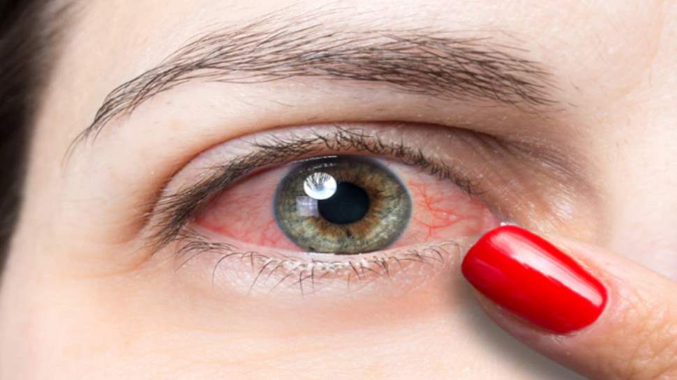 डायबिटीज की वजह से आंखों से जुड़ी बीमारियां eye disease