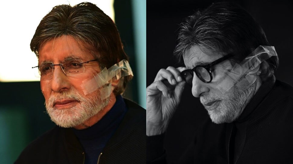 Amitabh Bachchan wrote a long blog after surgery, shared these photos