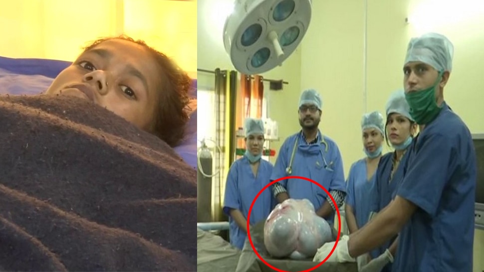Bhopal: डॉक्टरों ने 20 साल की लड़की के पेट से निकाला 16 KG का Tumour, 6 घंटे तक चला ऑपरेशन
