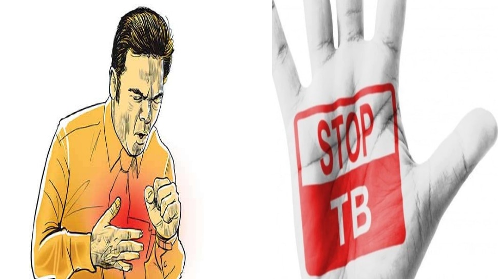 World TB Day 2021: लाइलाज नहीं है लेकिन बेहद संक्रामक बीमारी है टीबी, समय रहते लक्षणों की करें पहचान