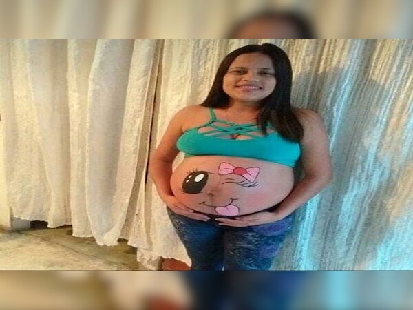 पीड़ित महिला यूलेजिस | फोटो साभार: डेली मेल