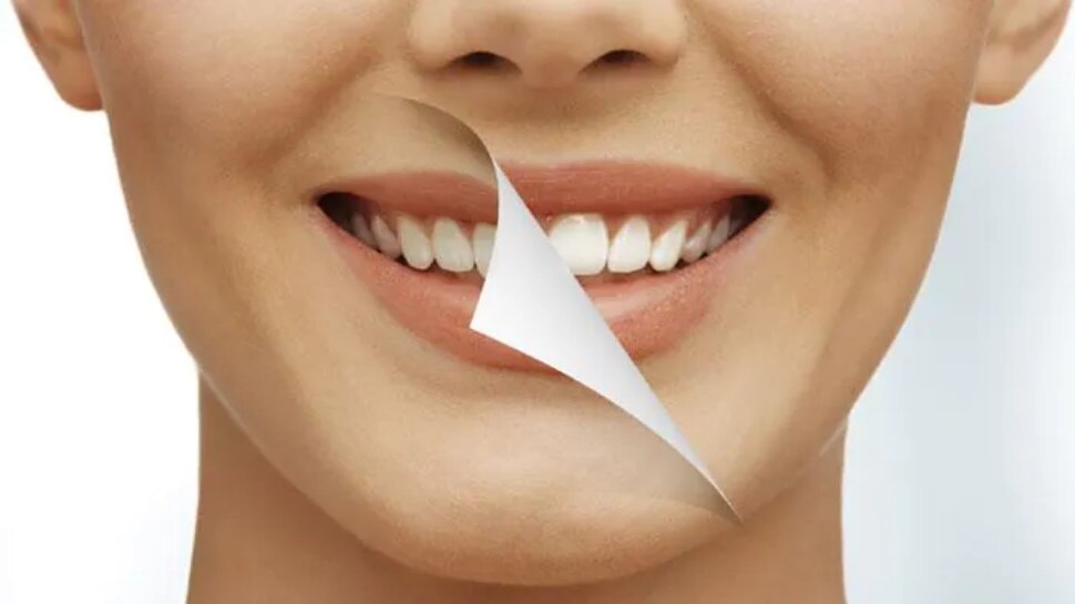 Home Remedies for White Teeth: पीले दांतों को करना हो झटपट सफेद, तो अपनाएं ये घरेलू उपाय