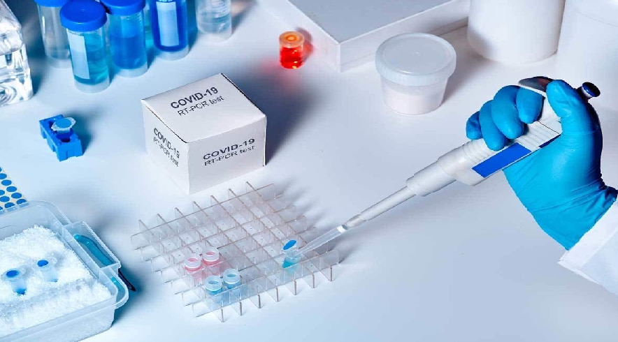 RT PCR जांच निगेटिव आने पर भी कोरोना के लक्षण हैं बरकारार, तो जानिए क्या करना चाहिए