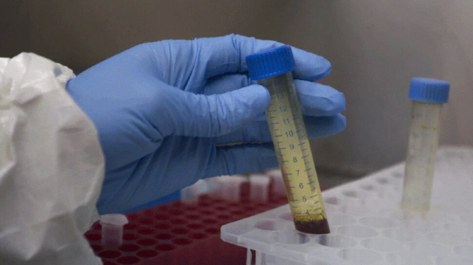Corona टेस्टिंग को लेकर ICMR ने जारी की नई गाइडलाइन, RT-PCR टेस्ट की अनिवार्यता पर कही ये बात