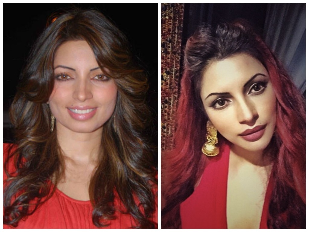 बोटॉक्स ट्रीटमेंट का असर Shama Sikander before and after botox