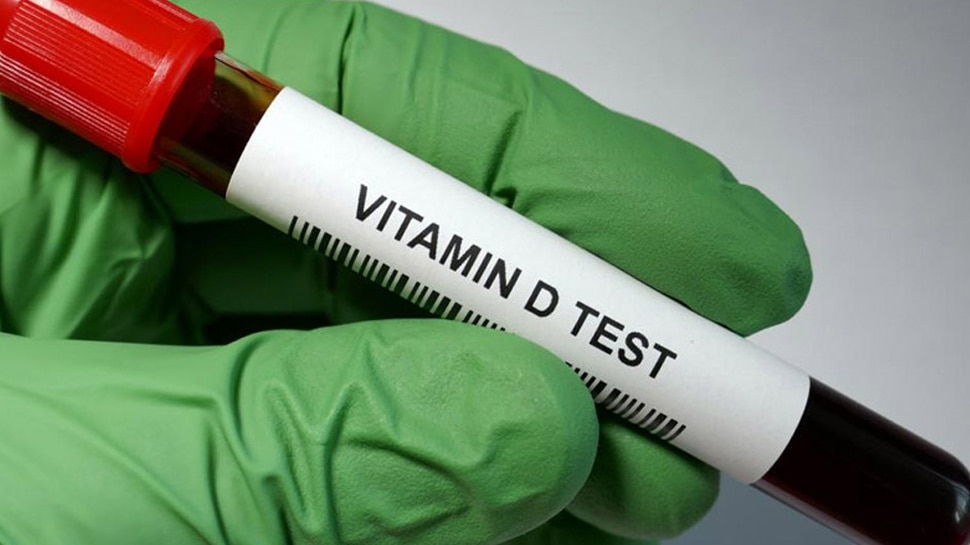 Vitamin d test