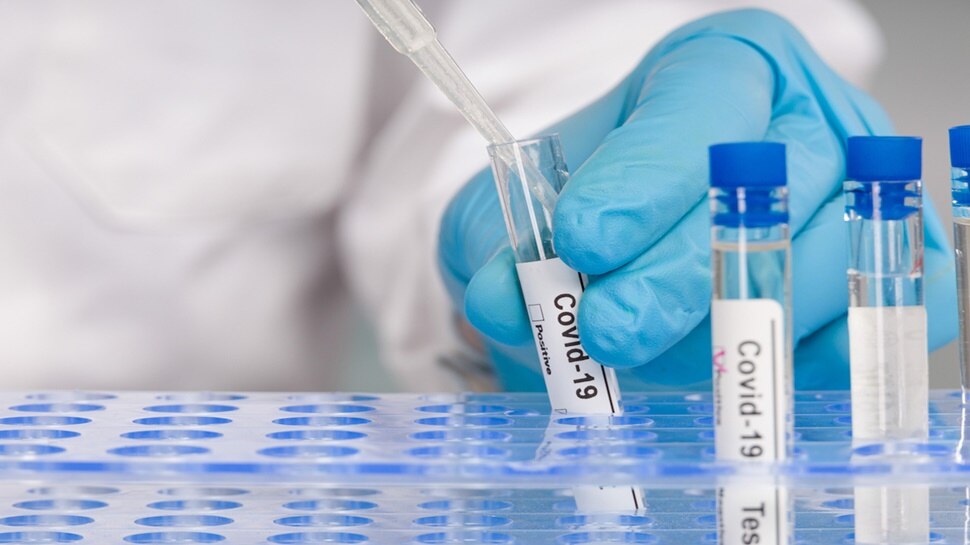 Coronavirus Antibody Test: क्या है एंटीबॉडी टेस्ट? बेवजह इसे क्यों नहीं करवाना चाहिए, जानिए
