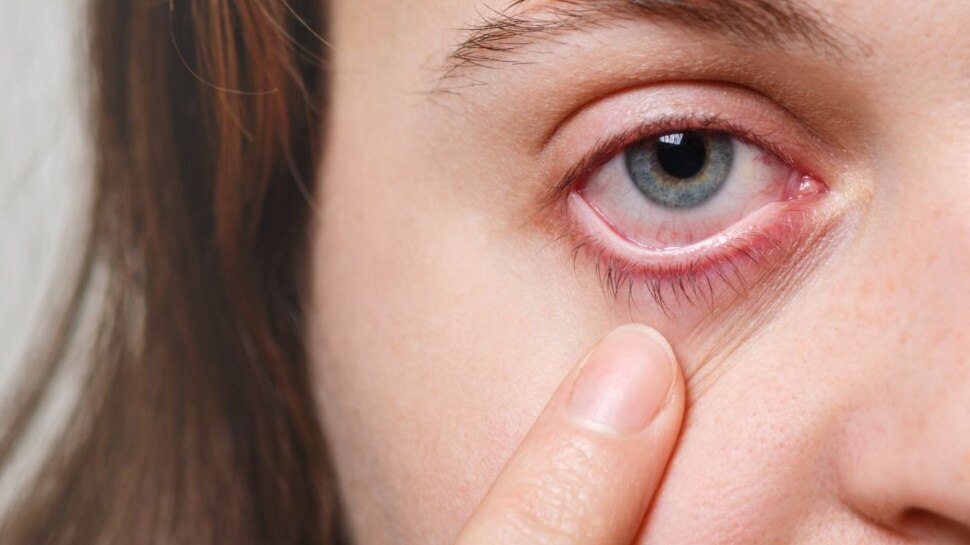 आंख, नाक और जबड़े को भी प्रभावित करता है यह फंगस fungus effects which part of body