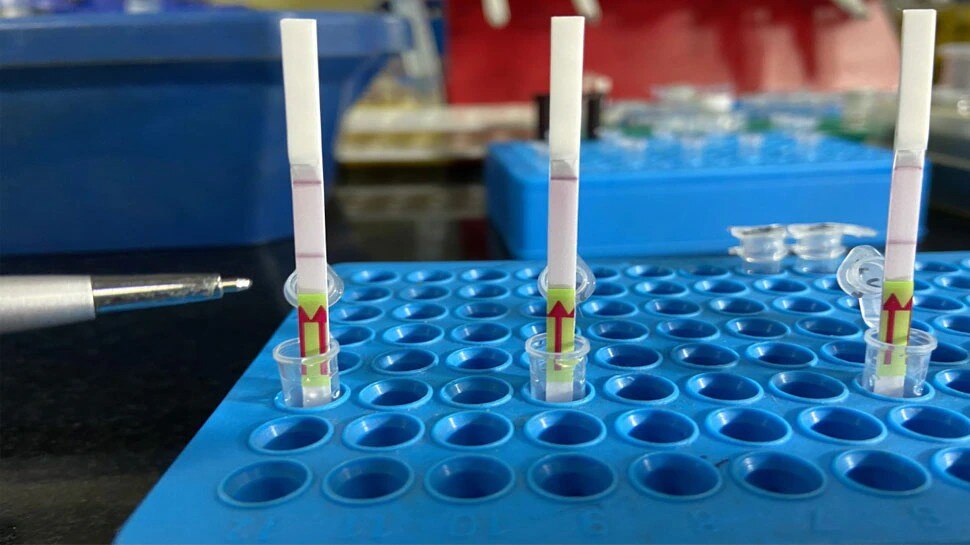 क्या है FELUDA टेस्ट जो मिनटों में देता है कोरोना रिपोर्ट, RT-PCR से कितना है बेहतर? जानें