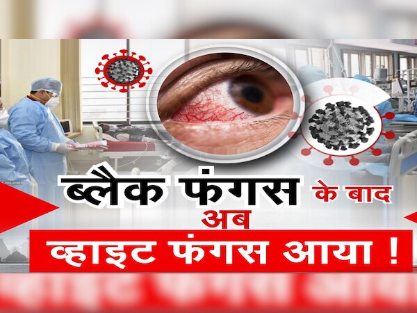 व्हाइट फंगस.