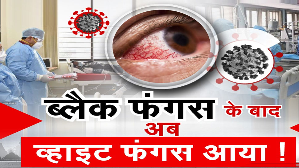 व्हाइट फंगस. व्हाइट फंगस.
