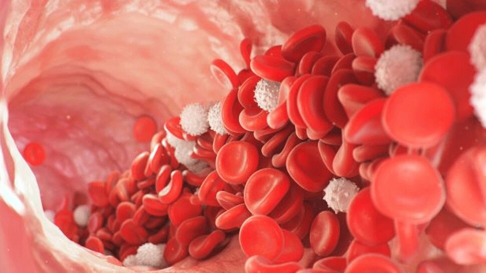 Blood clotting in arms can be dangerous 