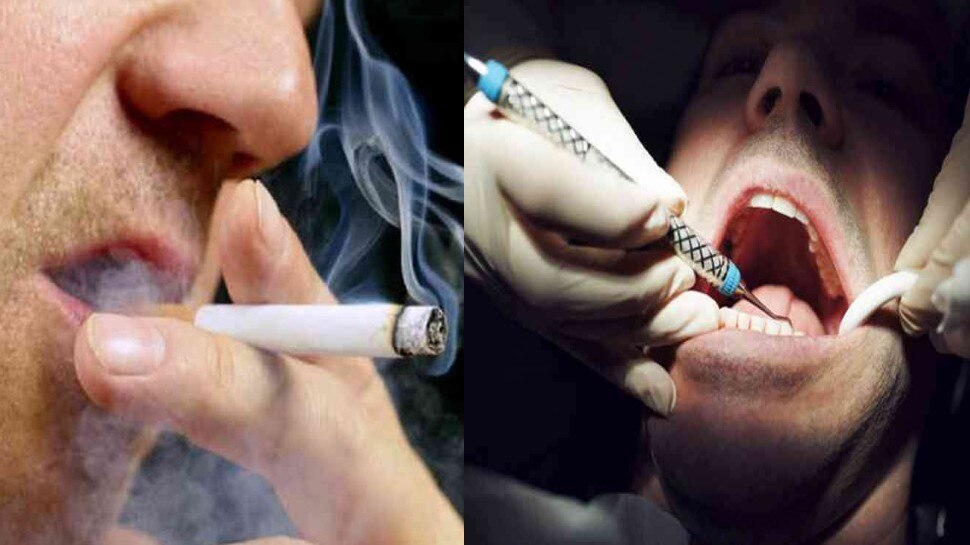 Side Effects Of Tobacco: तंबाकू का सेवन करने वाले हो जाएं सावधान, कैंसर के अलावा हो सकती हैं ये गंभीर बीमारियां