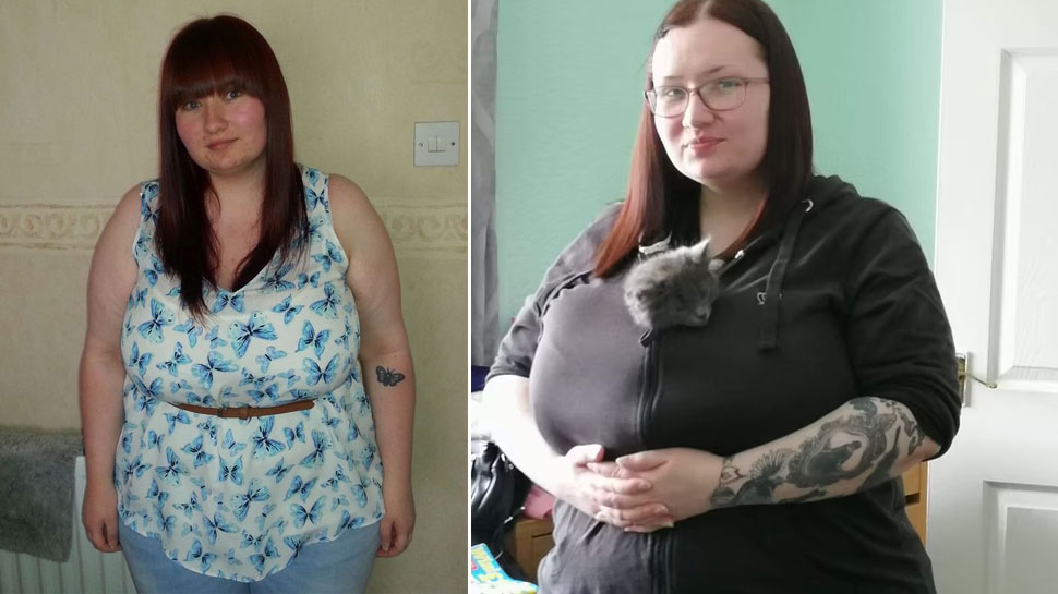 Young Scotswoman with 32K bust launches online appeal to raise cash for £7k  breast reduction op