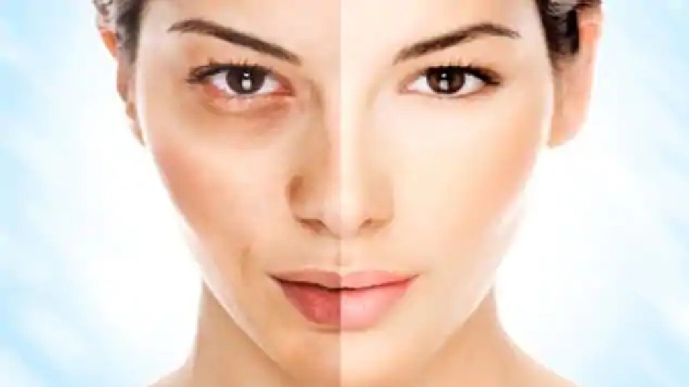 Beauty tips: आपको भी चाहिए खूबसूरत चेहरा तो शरीर में इन विटामिन्स की कमी कभी न होने दें