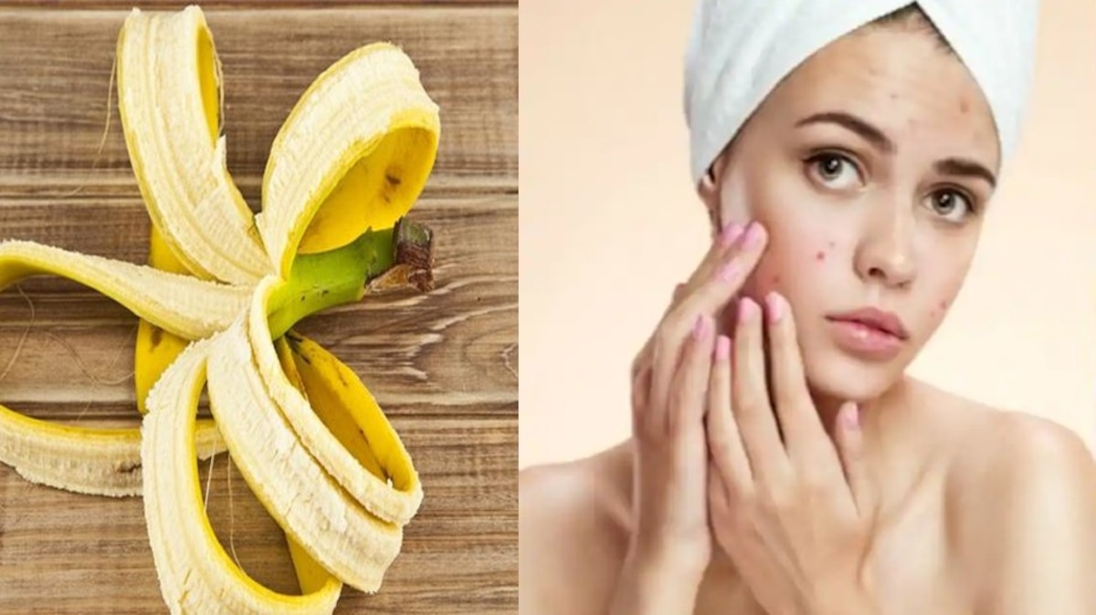 you remove pimples on face by banana peels know here remove wrinkles  problem and make face beautiful kela ke chilke ke fayde brmp | चेहरे के  दाग-धब्बे और आंखों के नीचे का कालापन दूर करने में कारगर हैं केले के छिलके,  बस ऐसे करना होगा इस्तेमाल | Hindi News ...