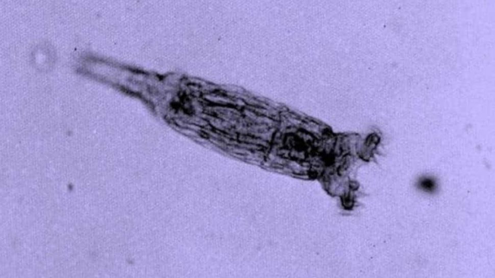 Organism: 25 हजार साल तक सोया रहा Creature, उठने के बाद खुला बड़ा राज