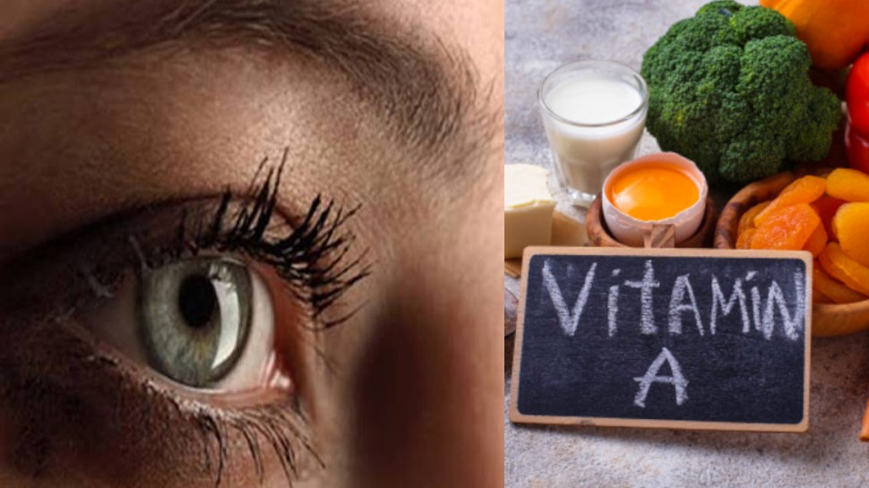 ये लक्षण बताते हैं शरीर में है विटामिन A की कमी, जरा सी लापरवाही से जा सकती है आंखों री रोशनी, जानें बचने का उपाय