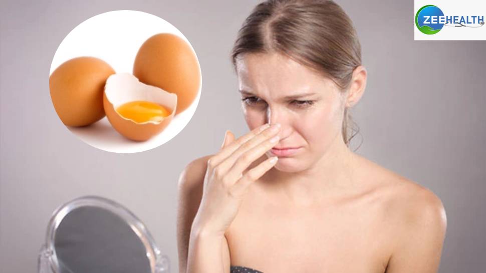 Beauty Tips: ब्लैकहेड्स से अंडा दिलाएगा छुटकारा, जानें सस्ता ब्यूटी हैक