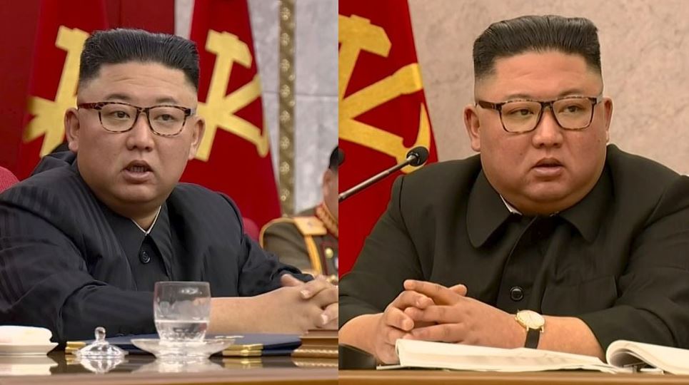 Kim Jong Un की हालत अब हो गई ऐसी, सूखकर कांटा हुआ तानाशाह