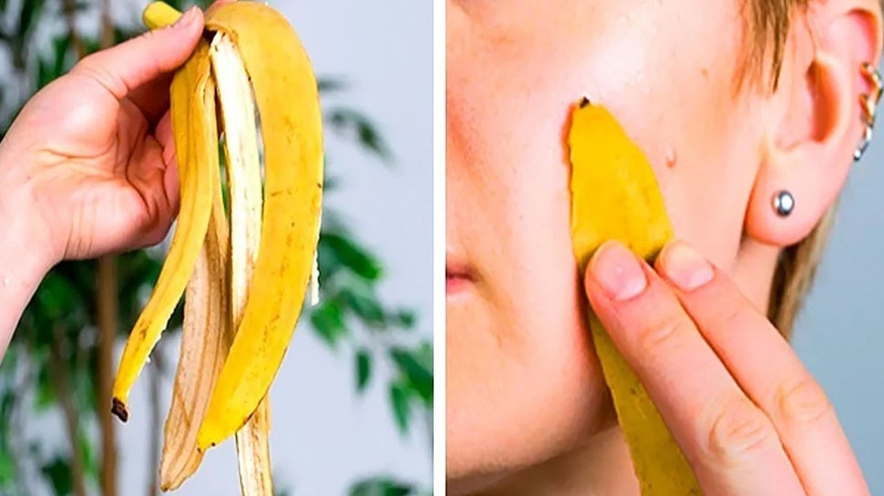 banana peel Reduces pimples and wrinkles