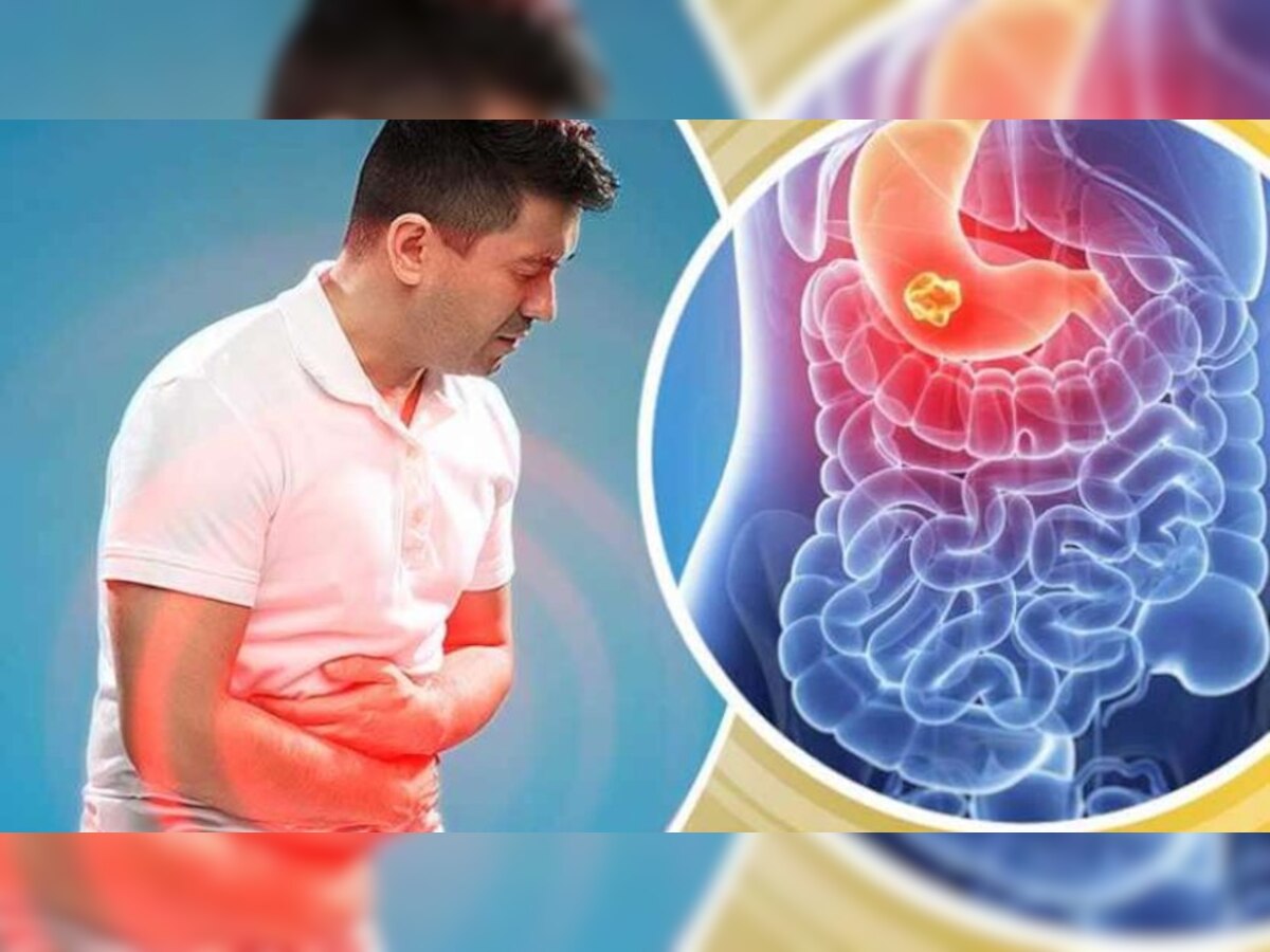 Stomach Cramps Home Remedies These things are beneficial in gas