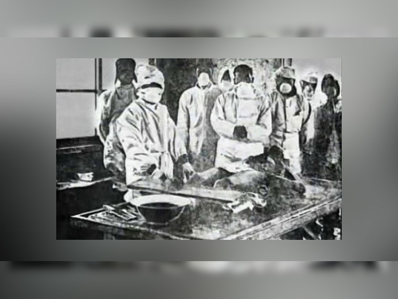 'बिना एनेस्थीसिया के बेहोश किए होते थे प्रयोग'