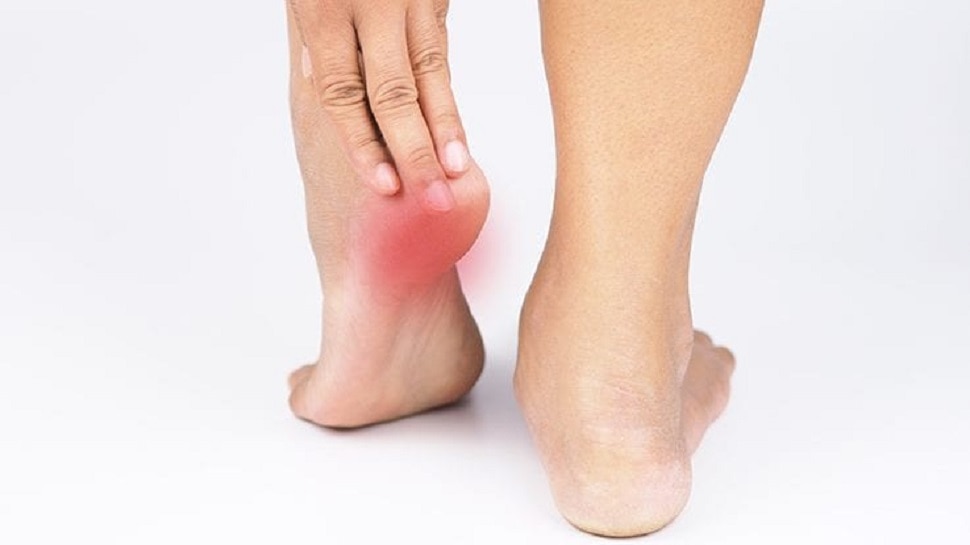Home Remedies For Heel Pain: These 4 Best Home Remedies To Get Rid Of Ankle  Pain Or Heel Pain - Heel Pain Remedies: एड़ियों के दर्द से छुटकारा पाने के  लिए अपनाएं
