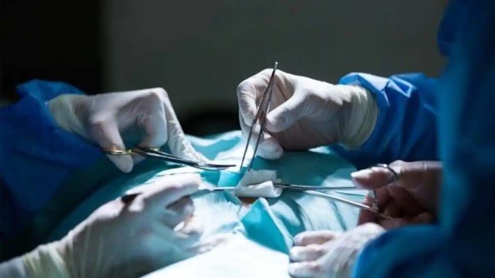 UP: डॉक्टरों की बड़ी लापरवाही, सर्जरी के दौरान महिला के पेट में छोड़ दिया कपड़ा