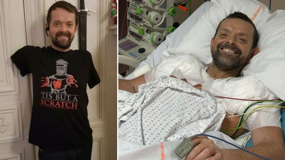 डॉक्टरों ने दिया जीवनदान Felix Gretarsson got new life after arms transplant