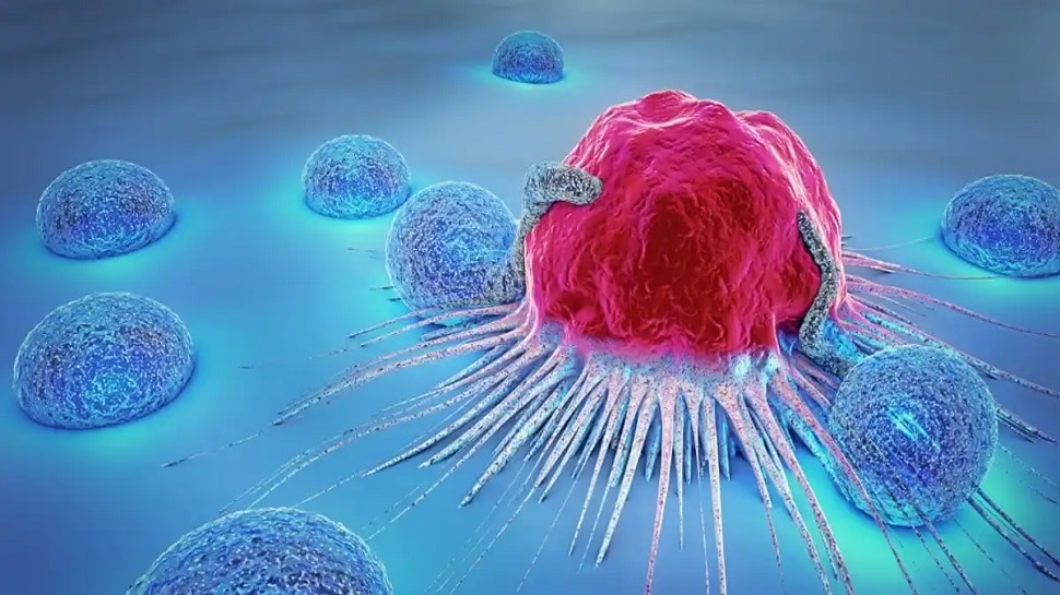 Cancer Stages: कैंसर की होती हैं 5 स्टेज, इस स्टेज के बाद बीमारी हो जाती है बेकाबू