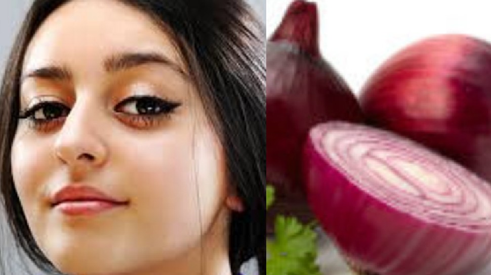 Onion for skin: 1 प्याज से दूर होंगे दाग-धब्बे और मुंहासे, चेहरा हो जाएगा खूबसूरत, जानें उपयोग का तरीका