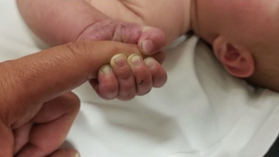 Twin growing in baby girls stomach in israel doctors shocked viral news |  Israel: नवजात के पेट में पल रहे थे 2 Twin Baby, ऐसे हुआ खुलासा | Hindi  News, दुनिया