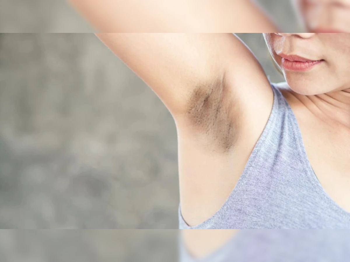 how to remove dark underarms how to clean underarms BRMP Remove the