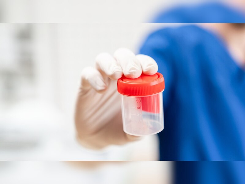 मरने से पहले फ्रीज करा दिया था स्पर्म