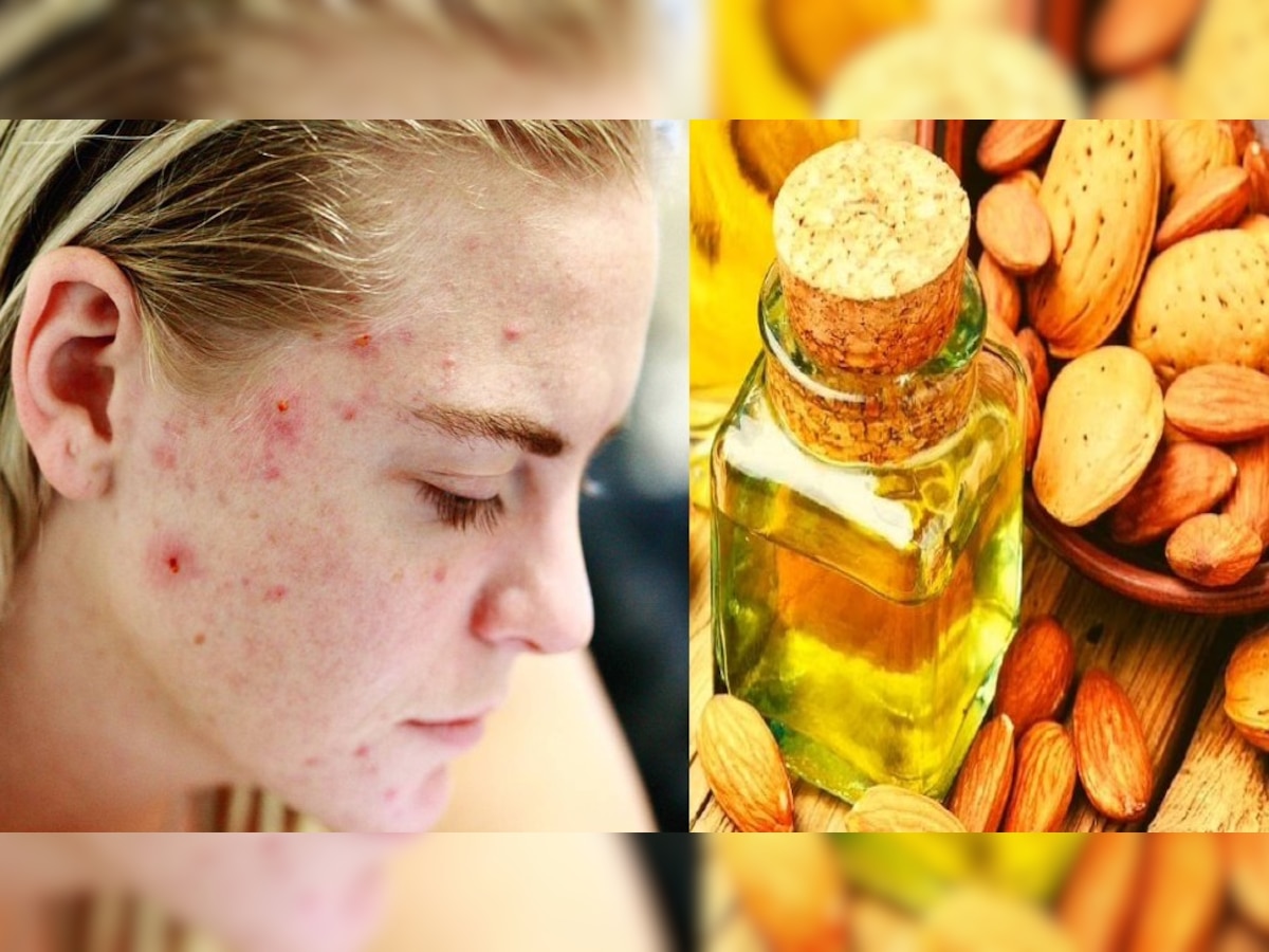 Benefits of almond oil for skin know here Almond oil will eliminate