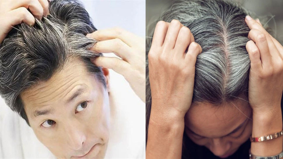 White hair at a young age, Are you also troubled by this problem? Follow  this panacea treatment | कम उम्र में बाल सफेद होने की समस्या से परेशान?  अपनाएं ये रामबाण इलाज |