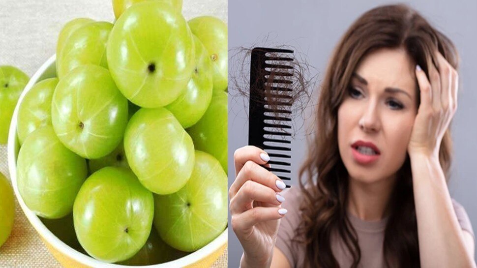 Amla pack for hair: टूटते बालों को रोकेगा आंवला, hair हो जाएंगे घने और करेंगे गबज की शाइनिंग