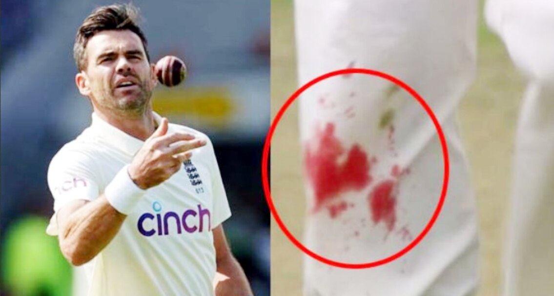 एंडरसन की ये फोटो देख नफरत करने वालों को भी होगा उनसे प्यार, फैन्स हुए हैरान