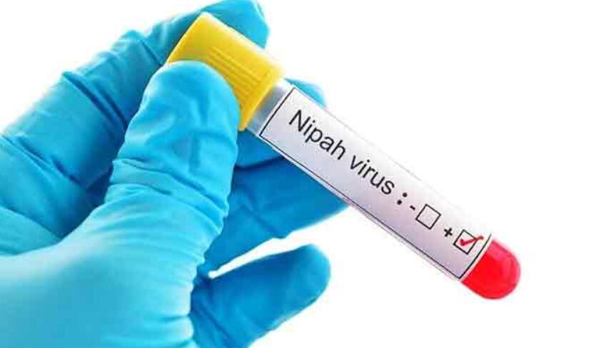 What is Nipah Virus:जानिए क्या है निपाह वायरस, कितना है खतरनाक और बचने का तरीका