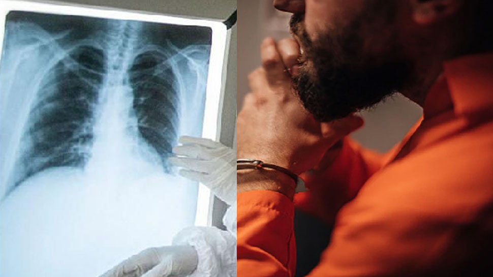 कैदी का X-ray देख डॉक्टर के उड़ गए होश, पेट में छिपाया था मोबाइल